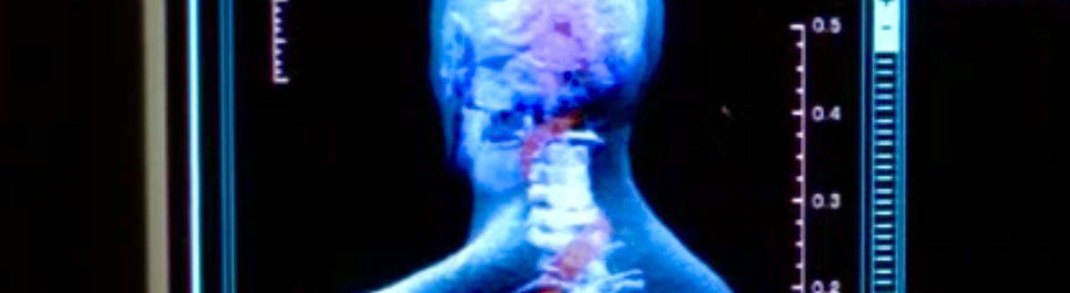 Banner. MRI of symbiote inside host